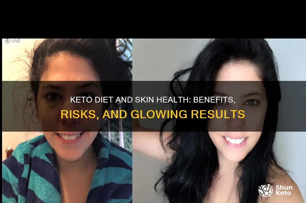 how does the keto diet affect your skin
