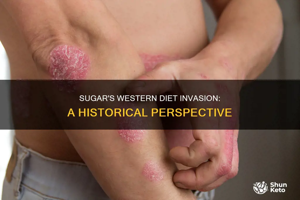 how does the sugar increased in western diet