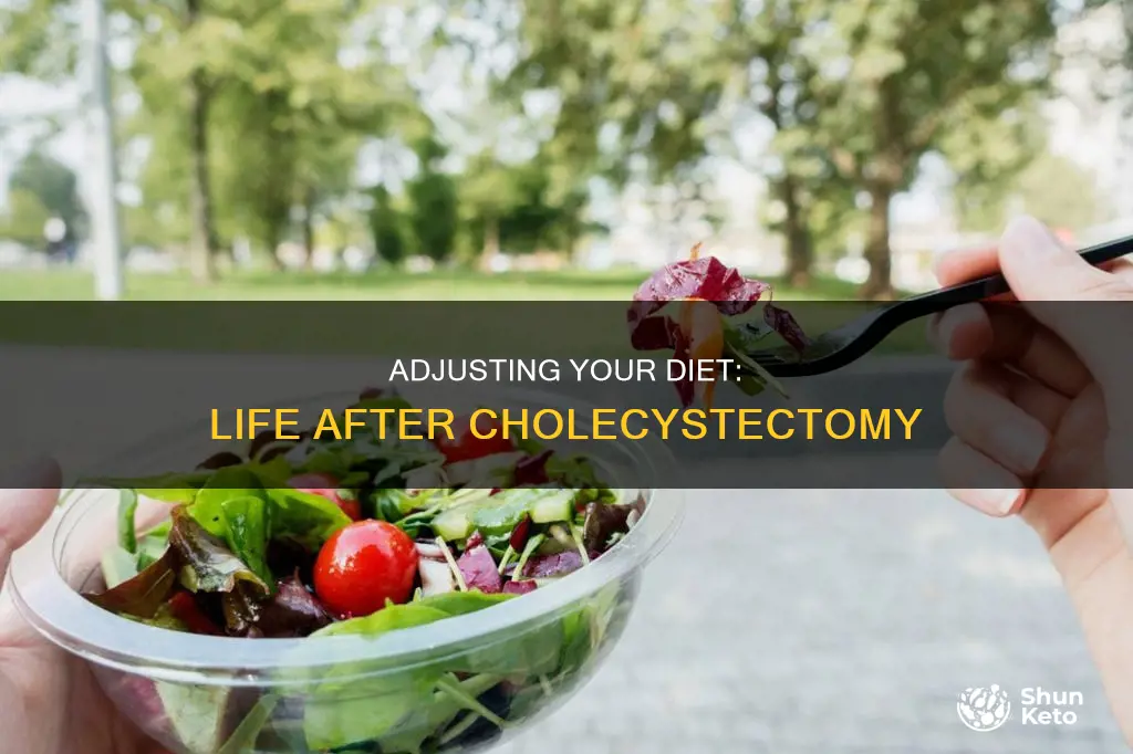 how does your diet need to change after a cholecystectomy