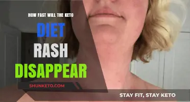 Keto Diet Rash: How Quickly Can You Expect It to Fade?