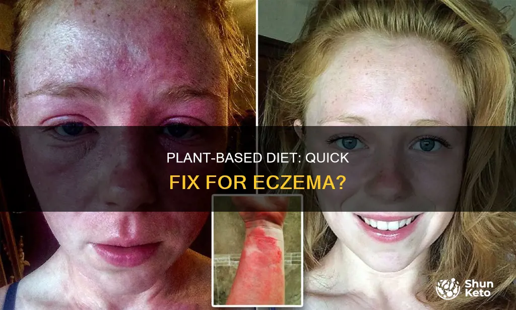 how fast would a plant based diet help myeczema