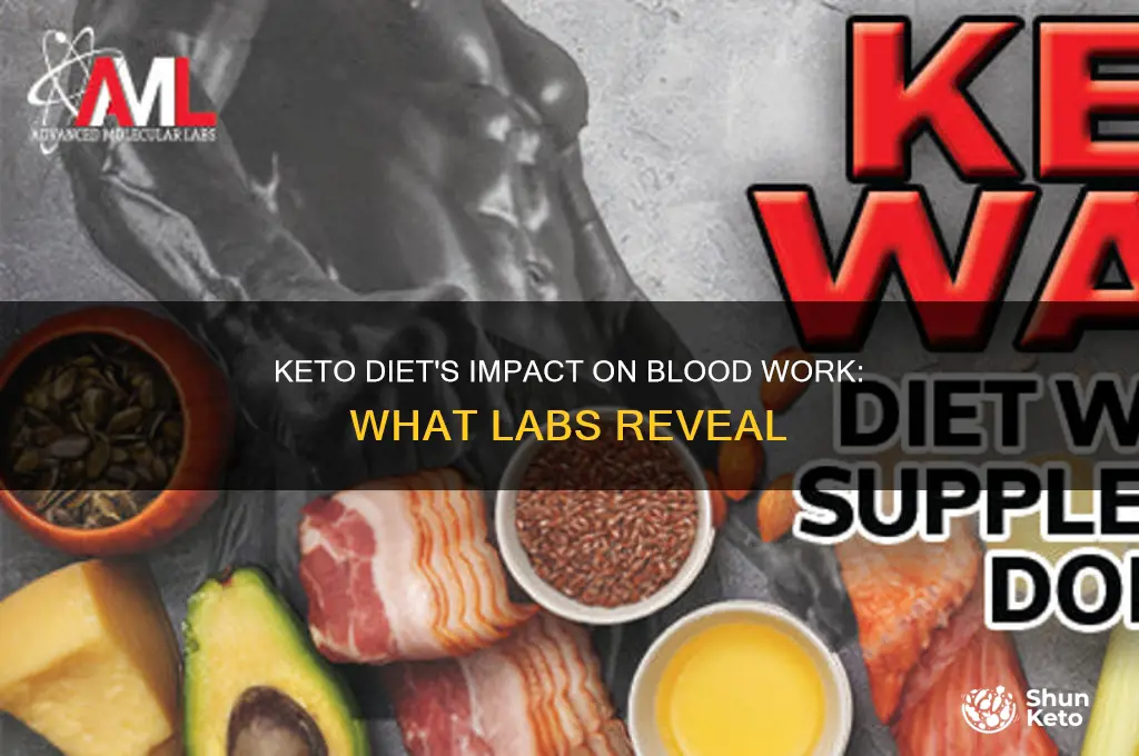 how keto diet affects labs