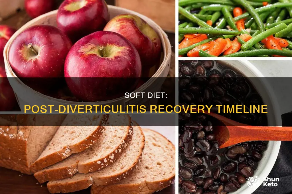 how long am i on a soft diet after diverticulitis