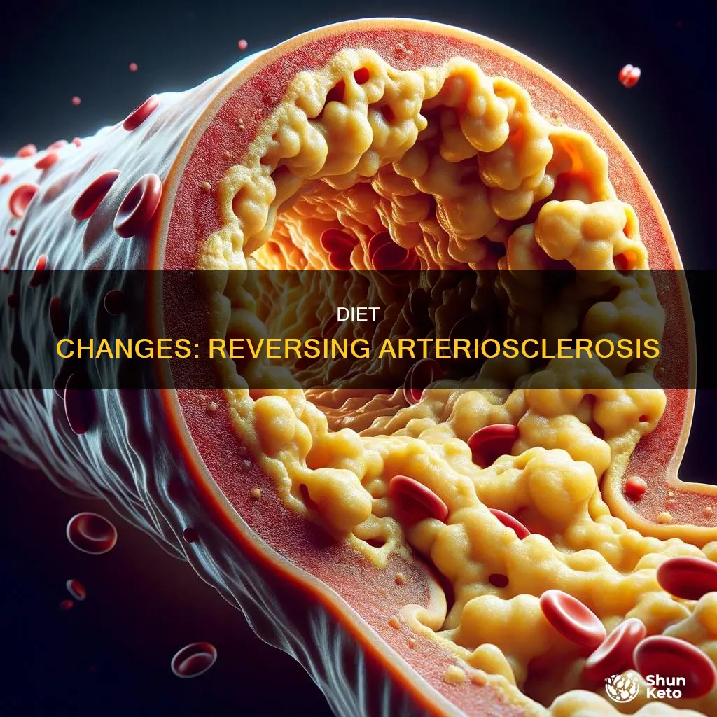 how long before diet changes arteriosclerosis