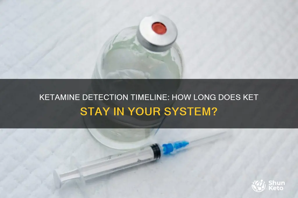 how long can ket stay in your system