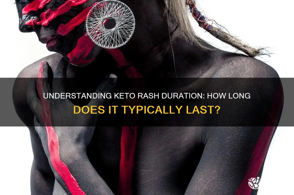 how long can the keto rash last