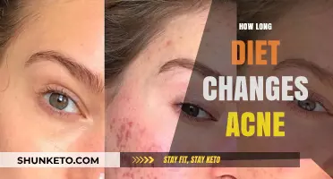 Diet Changes for Acne: How Long to See Results?