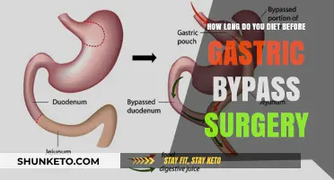 Pre-Op Dieting: How Long Before Gastric Bypass Surgery?