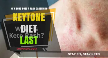 The Mystery of the Keto Rash Timeline