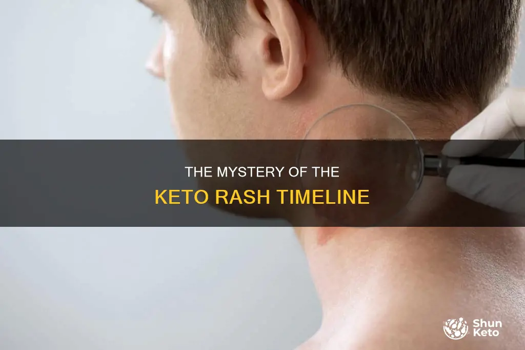 how long does a rash caused by keytone diet last