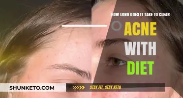 Diet's Role in Acne: Clearing Timeline