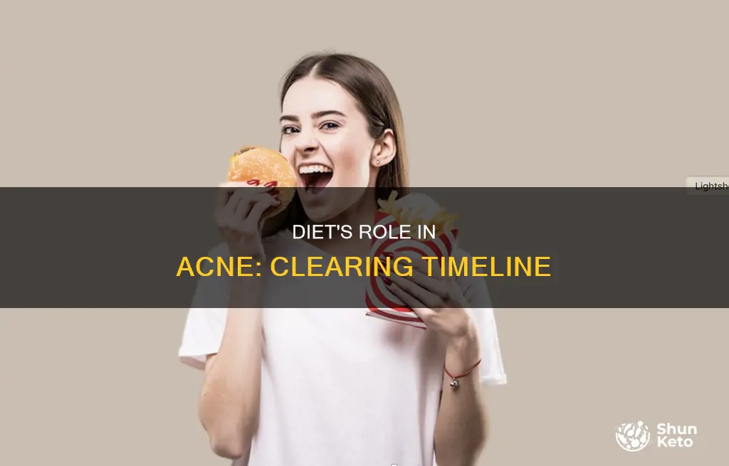 how long does it take to clear acne with diet