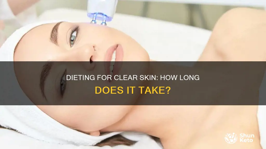 how long does it take to clear skin with diet