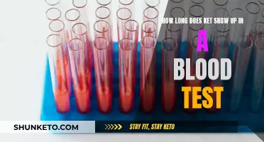 Blood Test and Ket: How Long Does it Last?