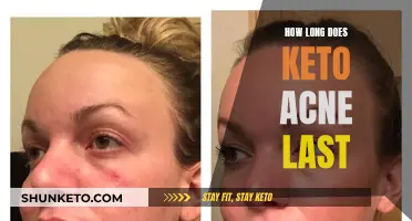 Battling Keto Acne: How Long Does the Skin Issue Last?