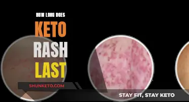 Keto Rash: How Long Does the Itch Last?