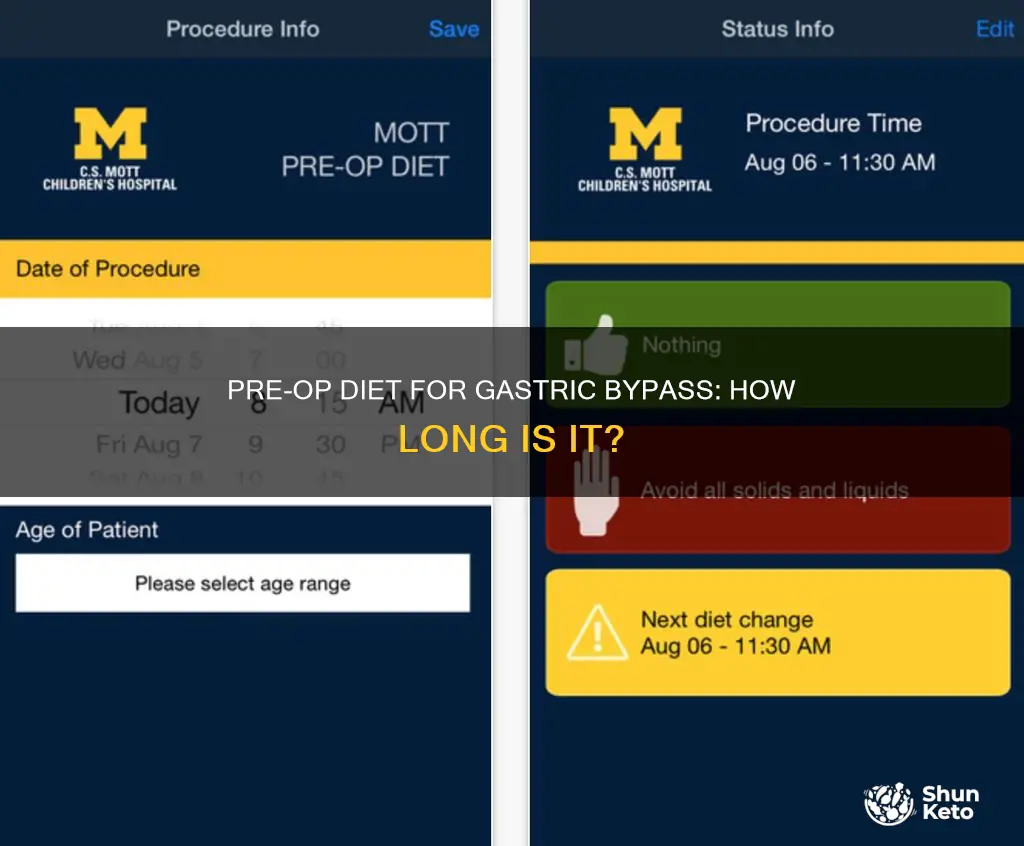 how long is the pre op diet for gastric bypass