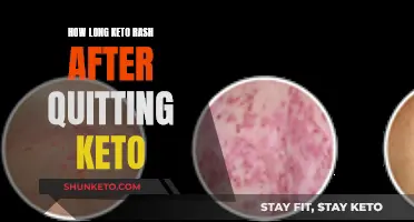 Keto Rash: Lingering Effects After Quitting the Diet