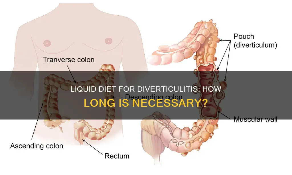how long on liquid diet for diverticulitis