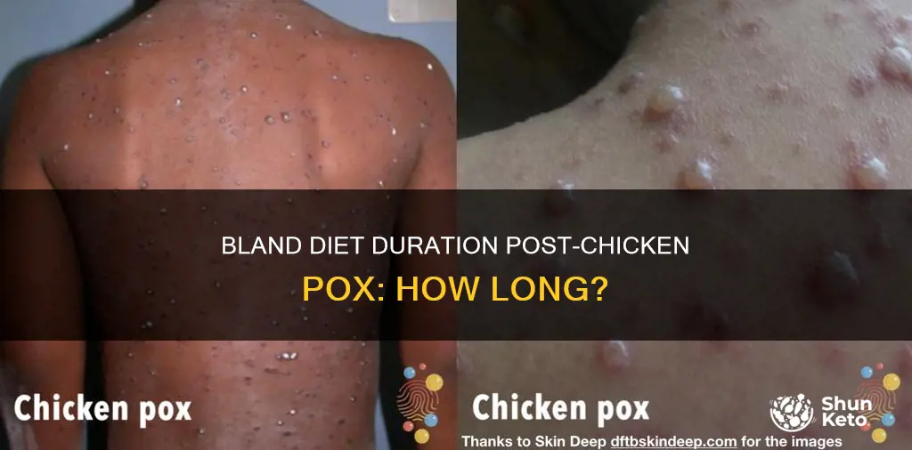 how long should be in bland diet after chicken pox
