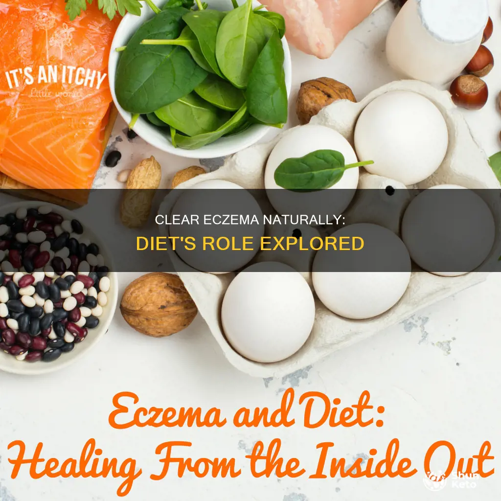 how long to clear eczemza with diet
