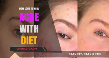 Acne Diet: Healing Time and What to Eat
