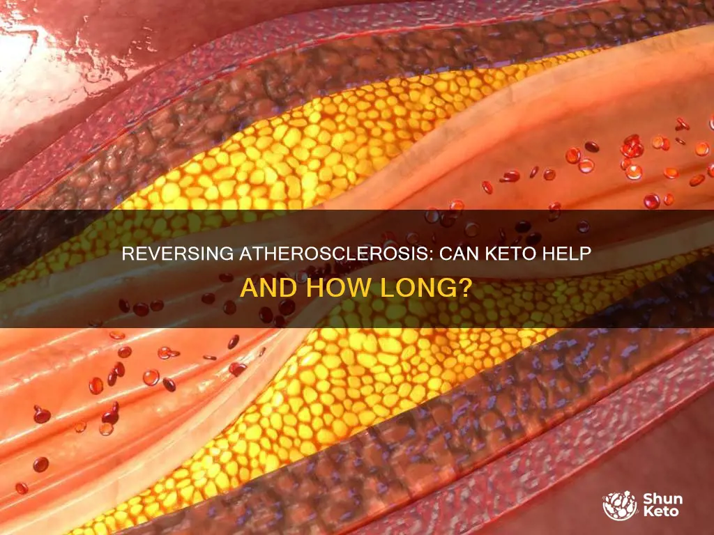 how long to reverse atherosclersis keto