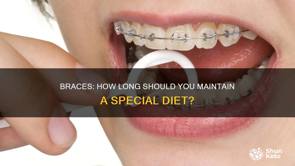 how long we have to mantain diet for braces