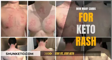 Keto Rash: Understanding Carb Intake to Prevent It