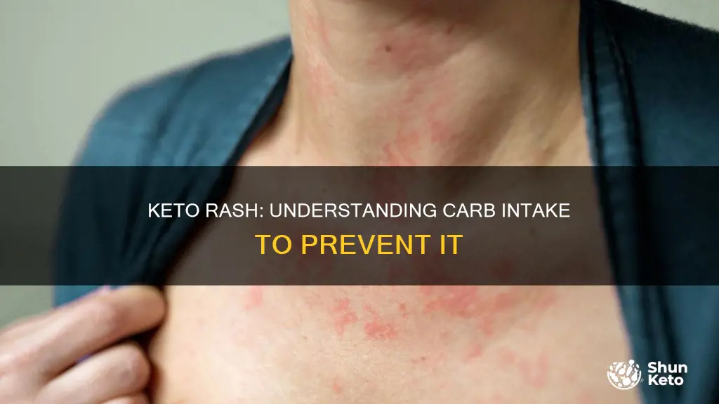 how many carbs for keto rash