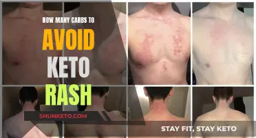 Avoiding Keto Rash: Carb Control and Prevention