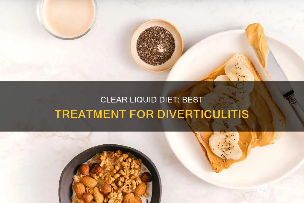 how many days clear liquid diet diverticulitis