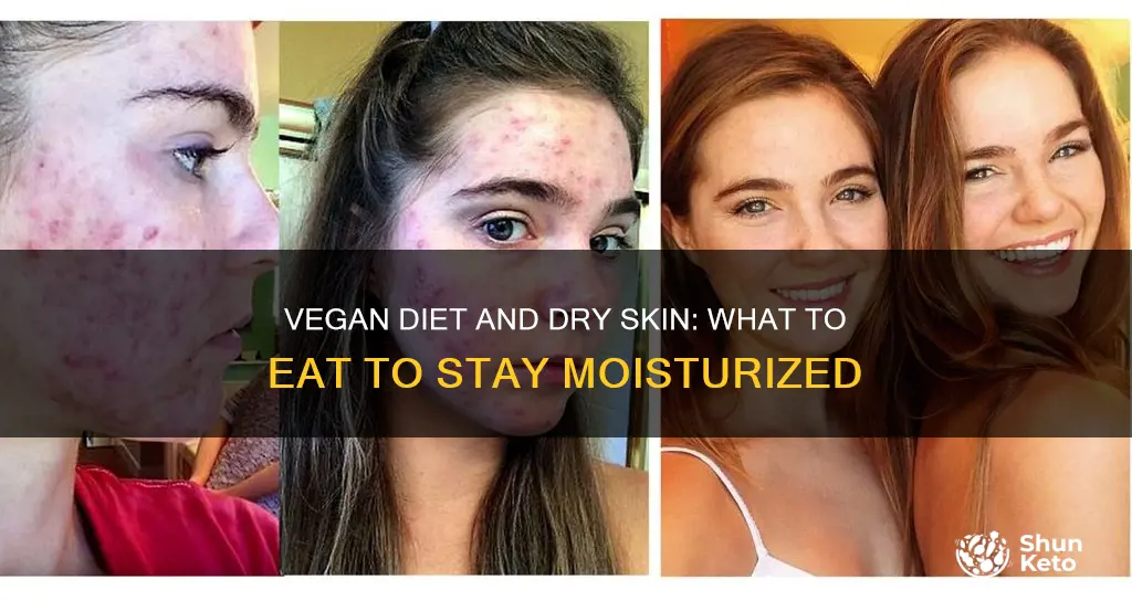 how to avoid dry skin on vegan diet