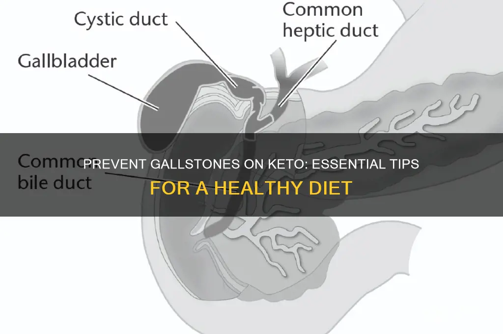 how to avoid gallstones on keto diet