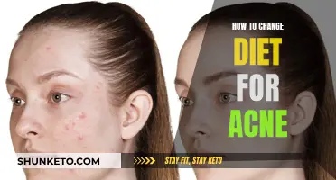 Acne Diet: Simple Food Swaps for Clear Skin