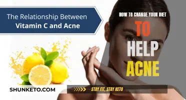 Clear Skin Diet: Foods to Eat and Avoid for Acne