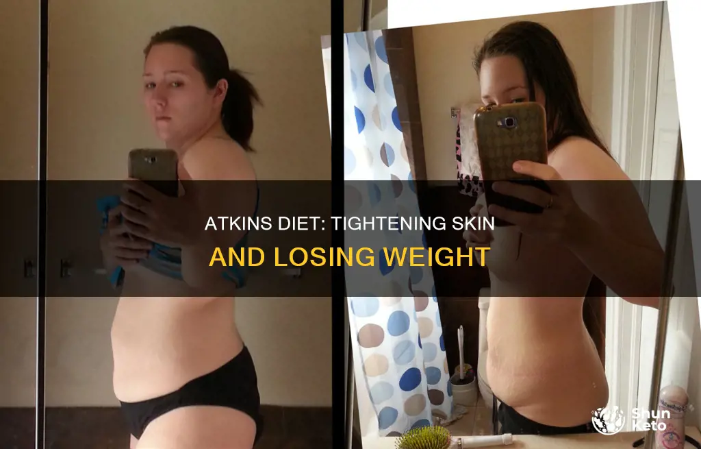 how to eliminate loose skin atkins diet