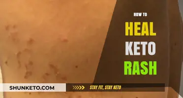 Soothing Keto Rash: A Comprehensive Guide to Healing and Prevention