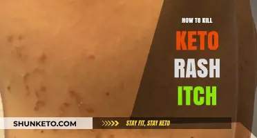 Conquering Keto Rash Itch: A Comprehensive Guide to Relief