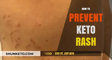 Preventing Keto Rash: Tips and Remedies for a Smooth Transition
