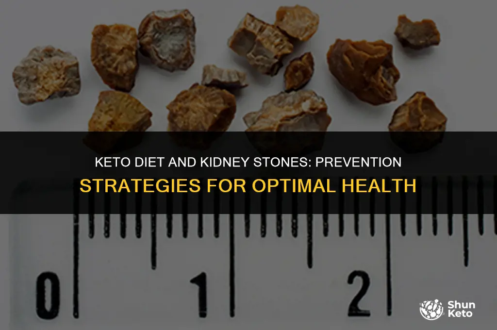 how to prevent kidney stones keto