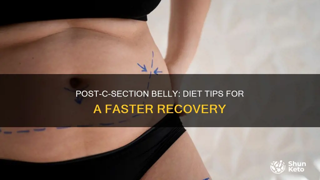 how to reduce belly after c section diet