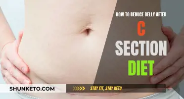 Belly-Busting Diet Strategies Post-Cesarean