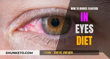 Clear Vision: Dietary Tips to Reduce Eye Floaters