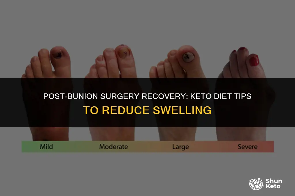 how to reduce swelling after bunion surgery keto