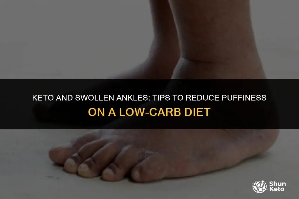 how to reduce swollen ankles on keto