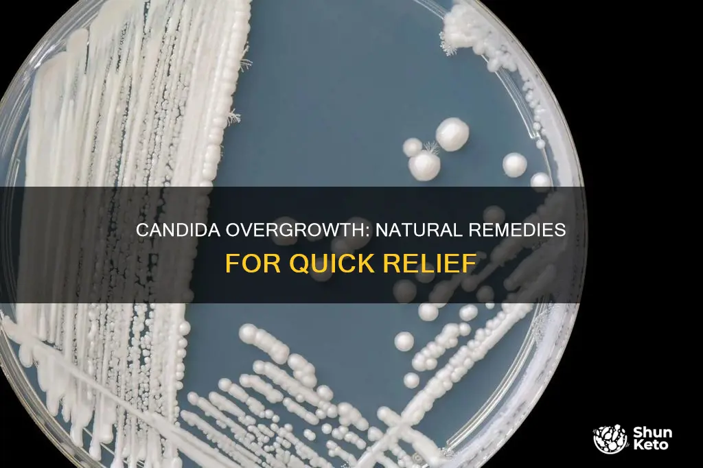 how to stop candida overgrowth without diet change