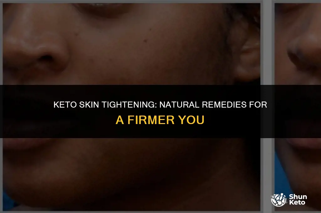 how to tighten loose skin on keto