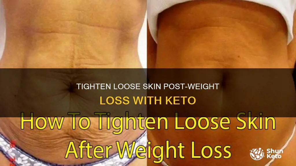 how to tone saggy skin after losing weight keto