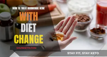 Treating Hormonal Acne: Diet Changes for Clear Skin